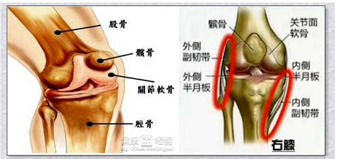 膝关节炎你了解吗？